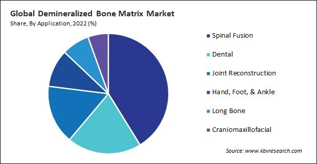 Demineralized Bone Matrix Market Share and Industry Analysis Report 2022