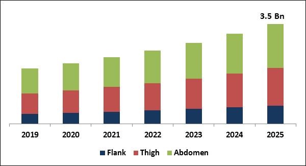 Facial Fat Transfer Market Size