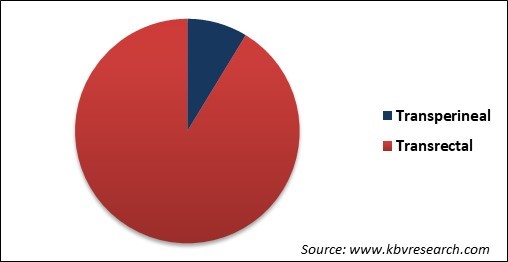 Fusion Biopsy Market Share