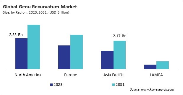 Genu Recurvatum Market Size - By Region