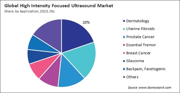 High Intensity Focused Ultrasound Market Share and Industry Analysis Report 2023