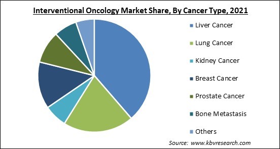 Interventional Oncology Market Share and Industry Analysis Report 2021