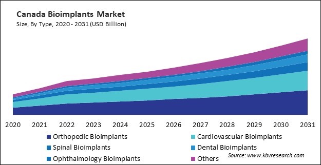 North America Bioimplants Market 