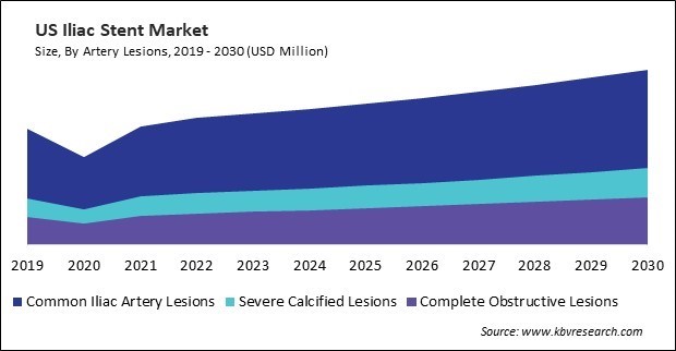 North America Iliac Stent Market