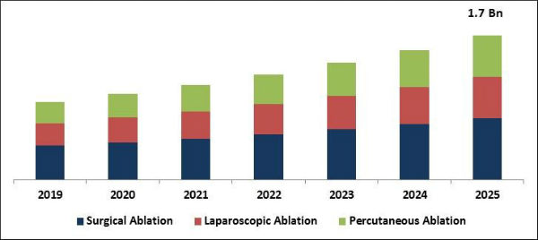 Tumor Ablation Market Size